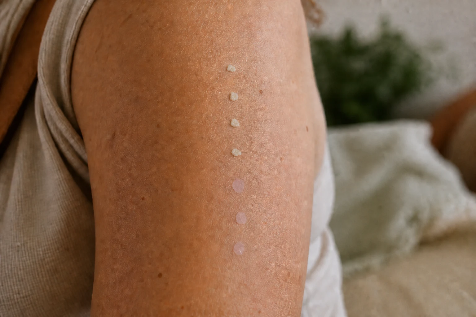 Illustrative close view of four tiny superficial Kambo gates on an upper arm, two covered with pale prepared medicine